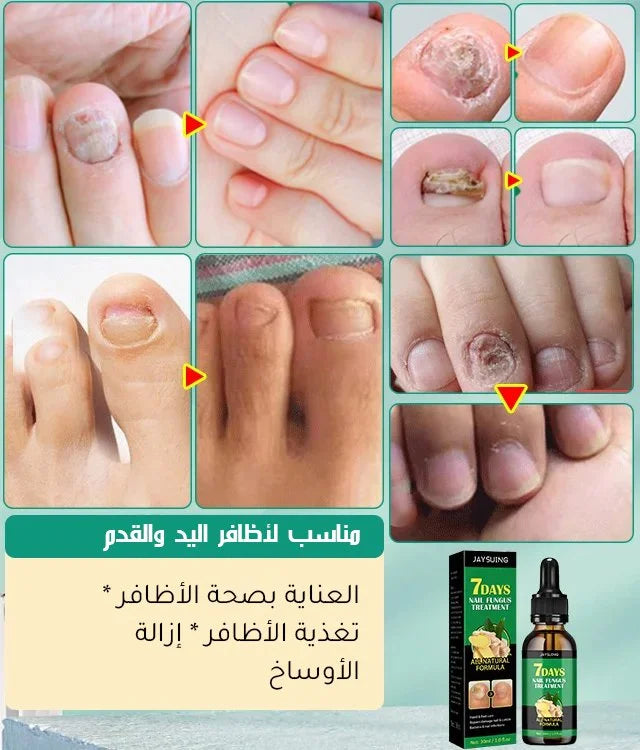 سائل العناية بالأظافر الغني بخلاصة الزنجبيل