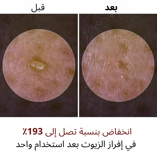 سيروم الأرز المقشر لبشرة مشرقة