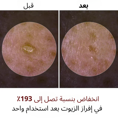 سيروم الأرز المقشر لبشرة مشرقة