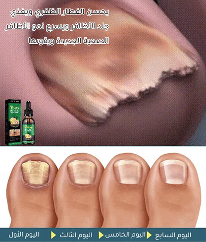 سائل العناية بالأظافر الغني بخلاصة الزنجبيل