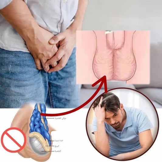 كريم علاج دوالي الخصية