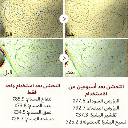 سيروم الأرز المقشر لبشرة مشرقة